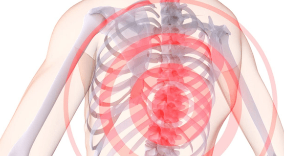 ការឈឺចាប់នៅឆ្អឹងខ្នងជាមួយនឹងជំងឺ osteochondrosis thoracic