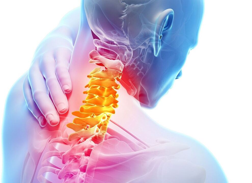 osteochondrosis នៃឆ្អឹងខ្នងមាត់ស្បូន